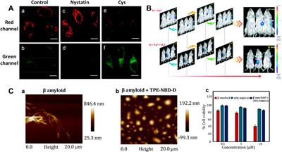 H2S-based fluorescent imaging for pathophysiological processes